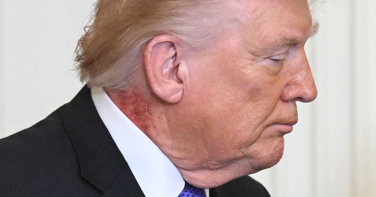 The Strategic Weaponization of Presidential Health: Information Control and Competitive Leverage