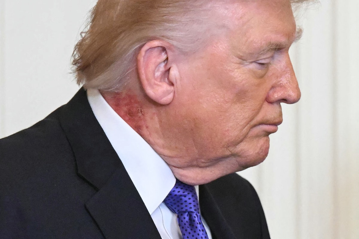 The Strategic Weaponization of Presidential Health: Information Control and Competitive Leverage
