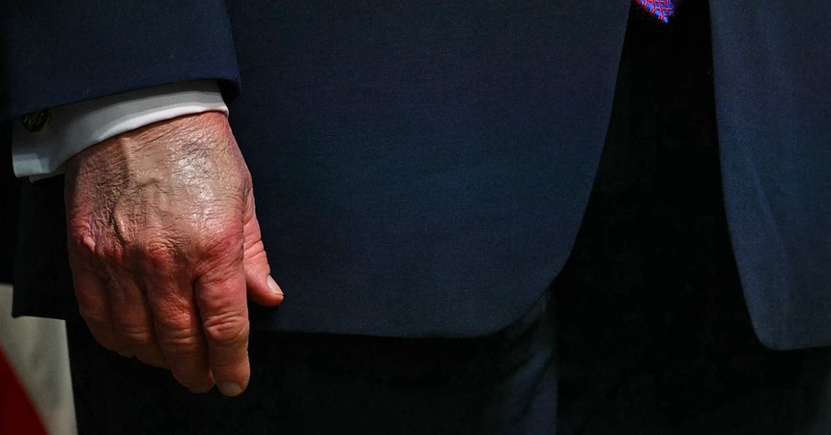 Trump's Walter Reed Exam: A Nexus of Political Scrutiny and Health Narrative Challenges