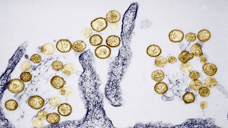 Hantavirus Outbreak on MV Hondius: 3 Deaths, 5 Suspected Cases Prompt Health Investigation