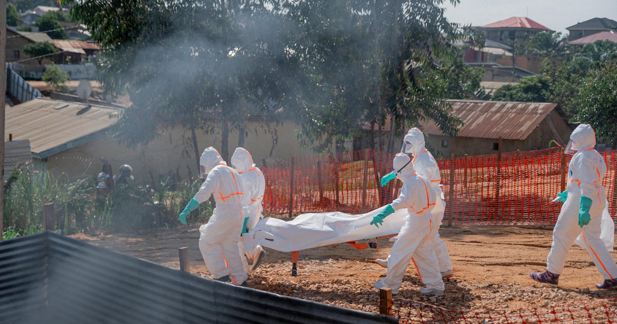 DRC Ebola Crisis: Financial Volatility and Epidemiological Surveillance Gaps