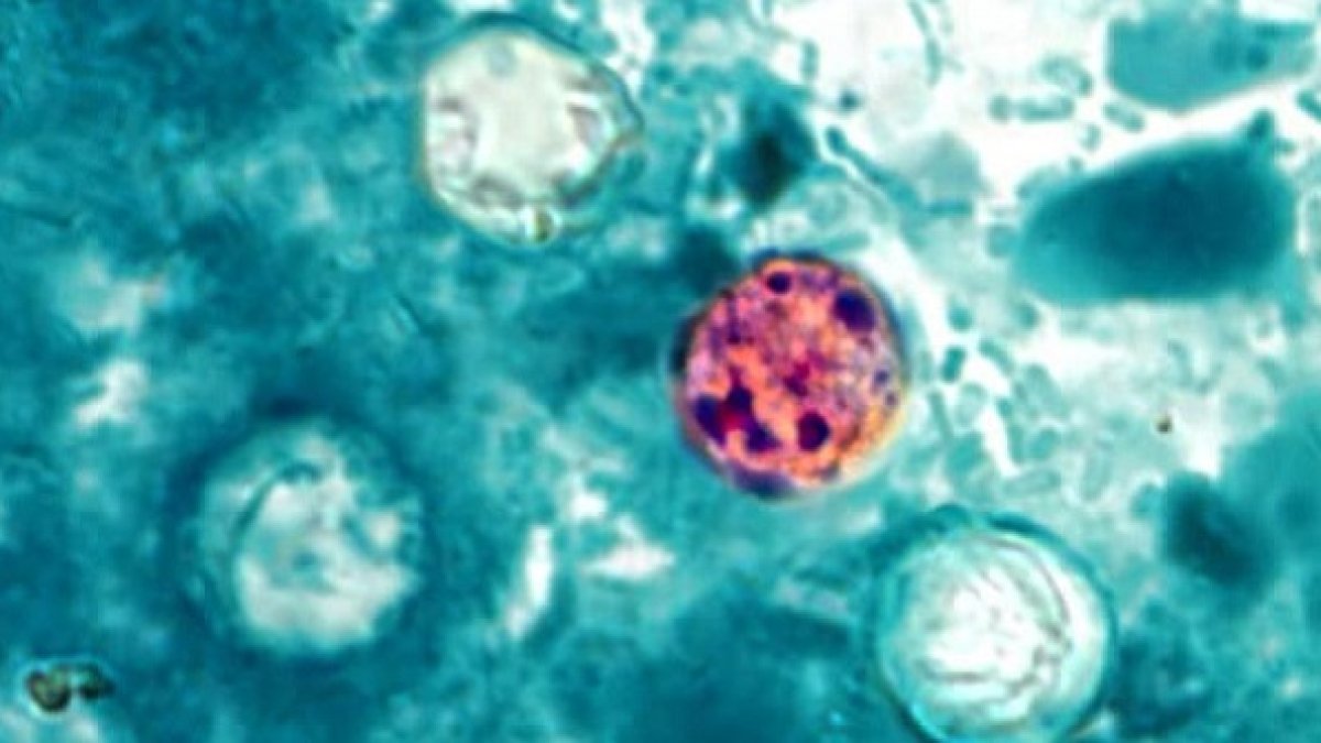 Cyclosporiasis Surge: Michigan Outbreak Reveals Systemic Supply Chain Vulnerabilities