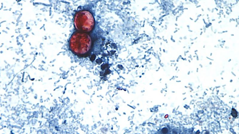 Cyclospora Outbreak Expands to Nine States Amid Supply Chain Scrutiny