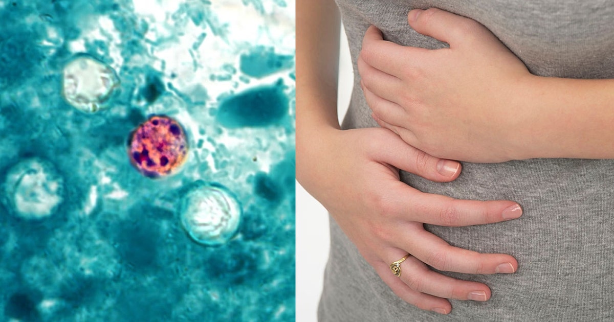 CDC Probes Systemic Food Supply Failures Amid Multi-State Cyclospora Outbreak