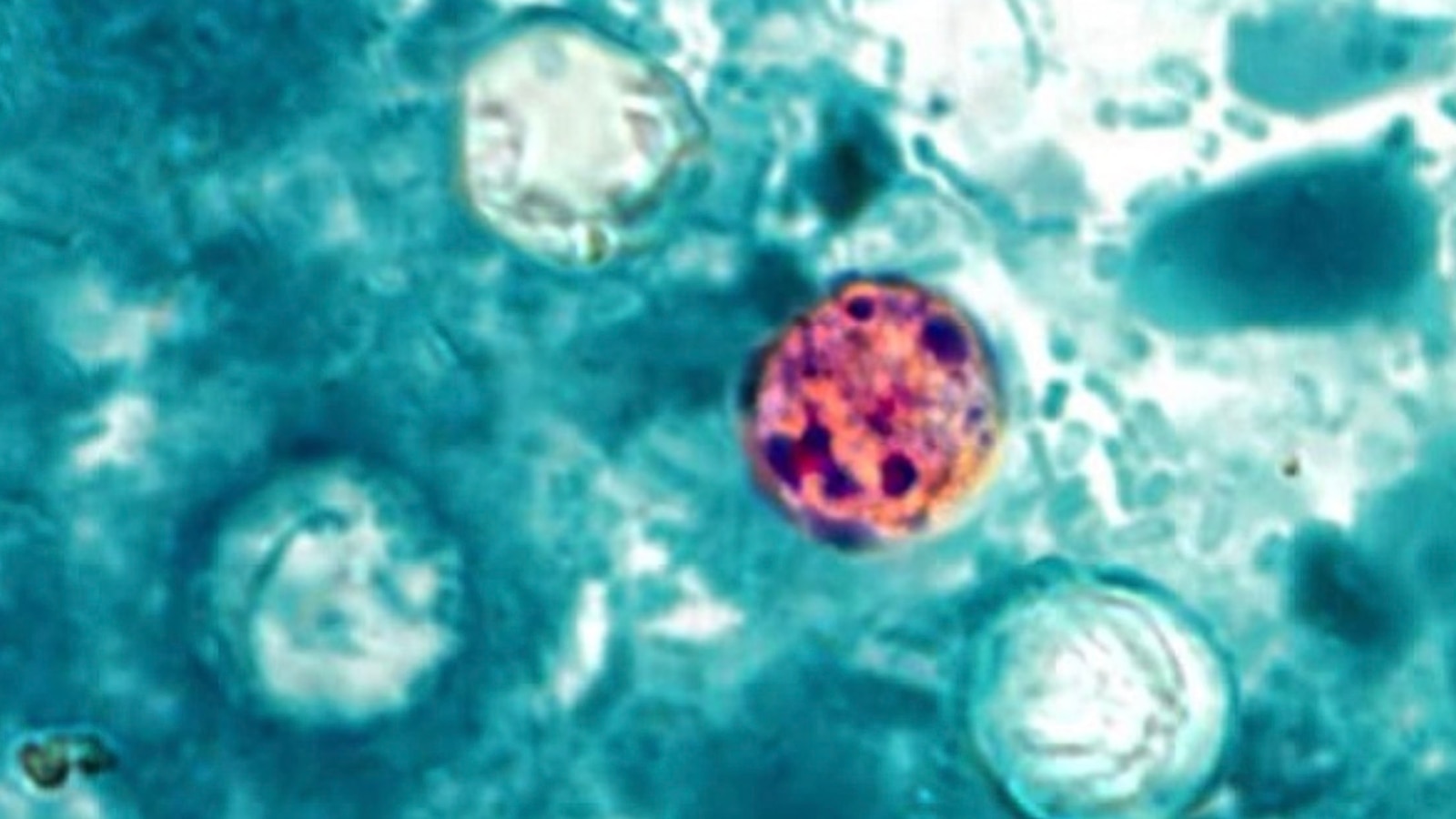 Cyclosporiasis Surge: Michigan Outbreak Reveals Systemic Supply Chain Vulnerabilities