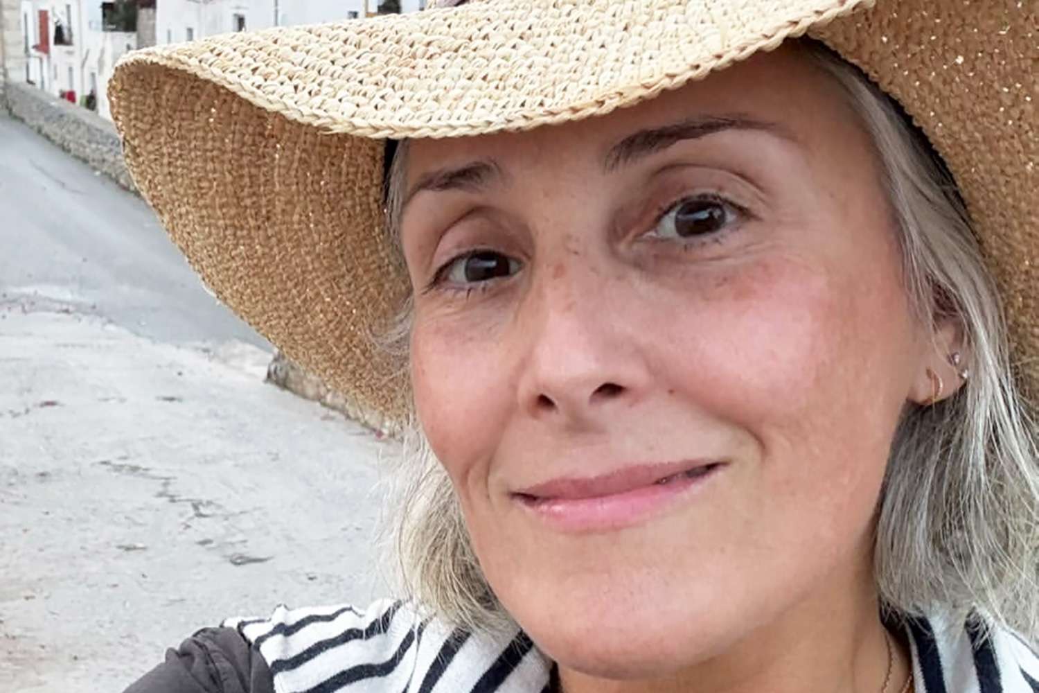 Ricki Lake’s Post-Weight Loss Aesthetic Strategy: A Case Study in Structural Transparency