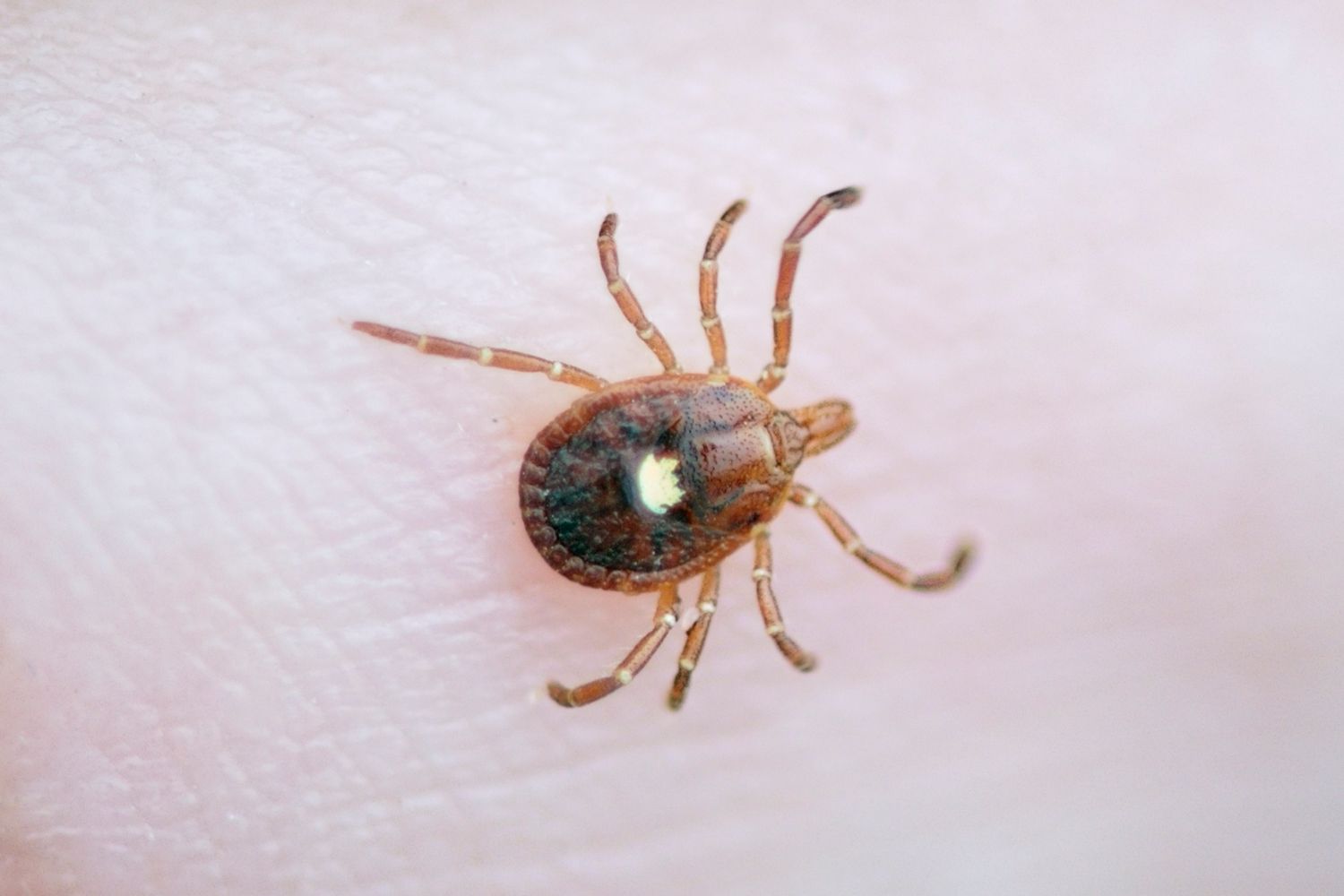 New York Confirms First Case of Untreatable Bourbon Virus